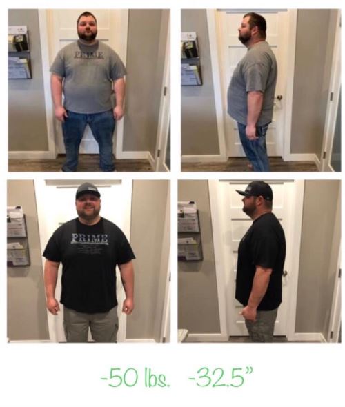 Weight Loss Before and After